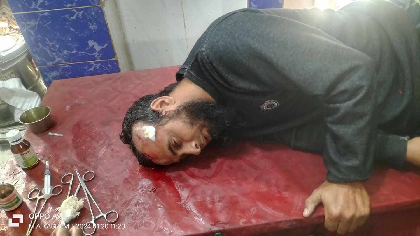 নালিতাবাড়ীতে জমি সংক্রান্ত বিরোধে ব্যাপক সংঘর্ষ, আহত ৩৩,আটক-৮