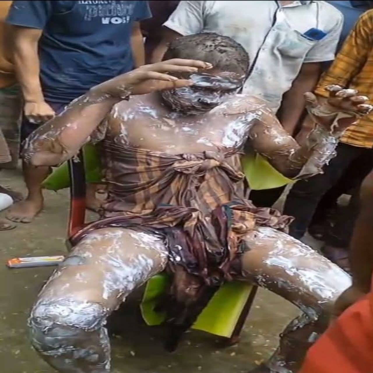 গাইবান্ধায় পারিবারিক কলহে শরীরে পেট্রল ঢেলে আগুন দেওয়া যুবকের মৃত্যু