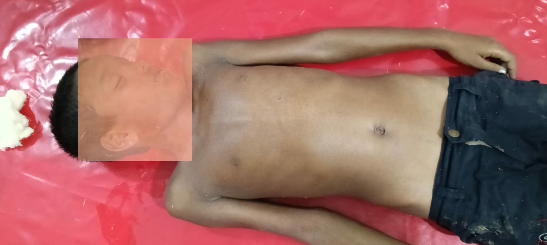 শেরপুরের নালিতাবাড়ীতে পুকুরের পানিতে ডুবে শিশুর মৃত্যু