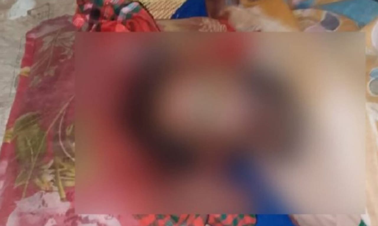 শ্বশুরকে ডাক্তার দেখাতে গিয়ে প্রাণ ঝরল পুত্রবধূর