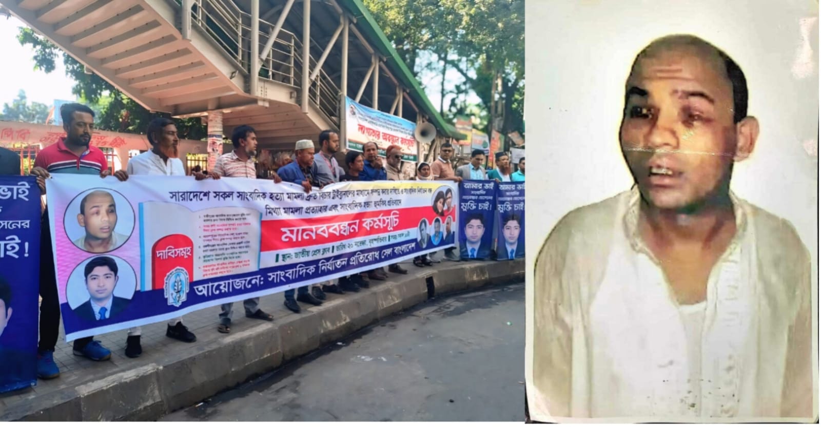 ৭ বছরেরও প্রত্যাহার হয়নি নির্যাতিত সাংবাদিক ফরিদুলের মামলা আইনের শাষণ কোথায়